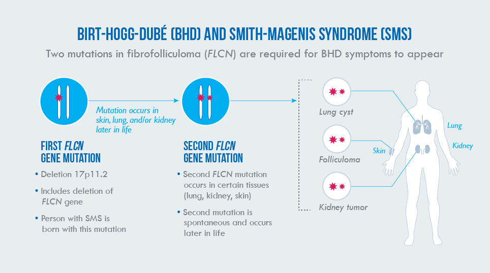 Graphic representing the two-hit hypothesis and how it applies to patients with SMS and their potential to develop BHD.